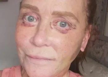 ‘I can’t close my eyes after horror movie surgery in Turkey’