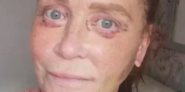 ‘I can’t close my eyes after horror movie surgery in Turkey’