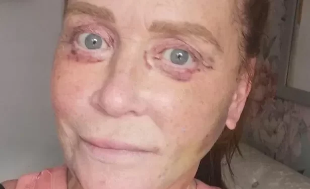 ‘I can’t close my eyes after horror movie surgery in Turkey’